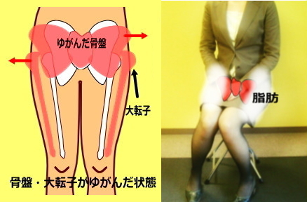 大転子　悪い座り方 - 膝下が曲がって見える、膝下が太い人の特徴